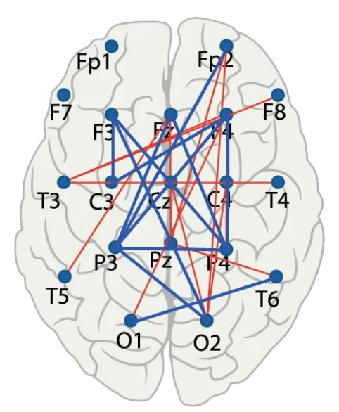 Connectivity Neurofeedback for Anxiety Treatment (1)